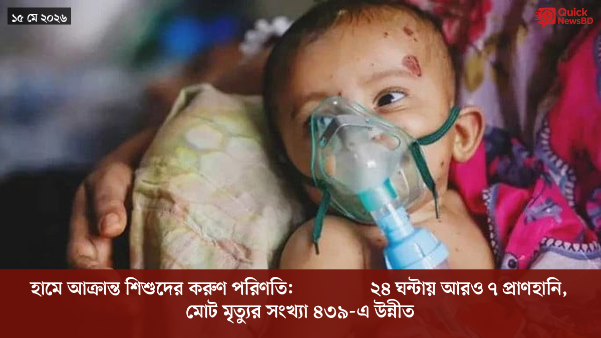 হামে আক্রান্ত শিশুদের করুণ পরিণতি: dernières ২৪ ঘন্টায় আরও ৭ প্রাণহানি, মোট মৃত্যুর সংখ্যা ৪৩৯-এ উন্নীত
